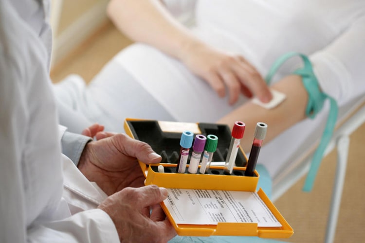 Prenatalni test.jpg