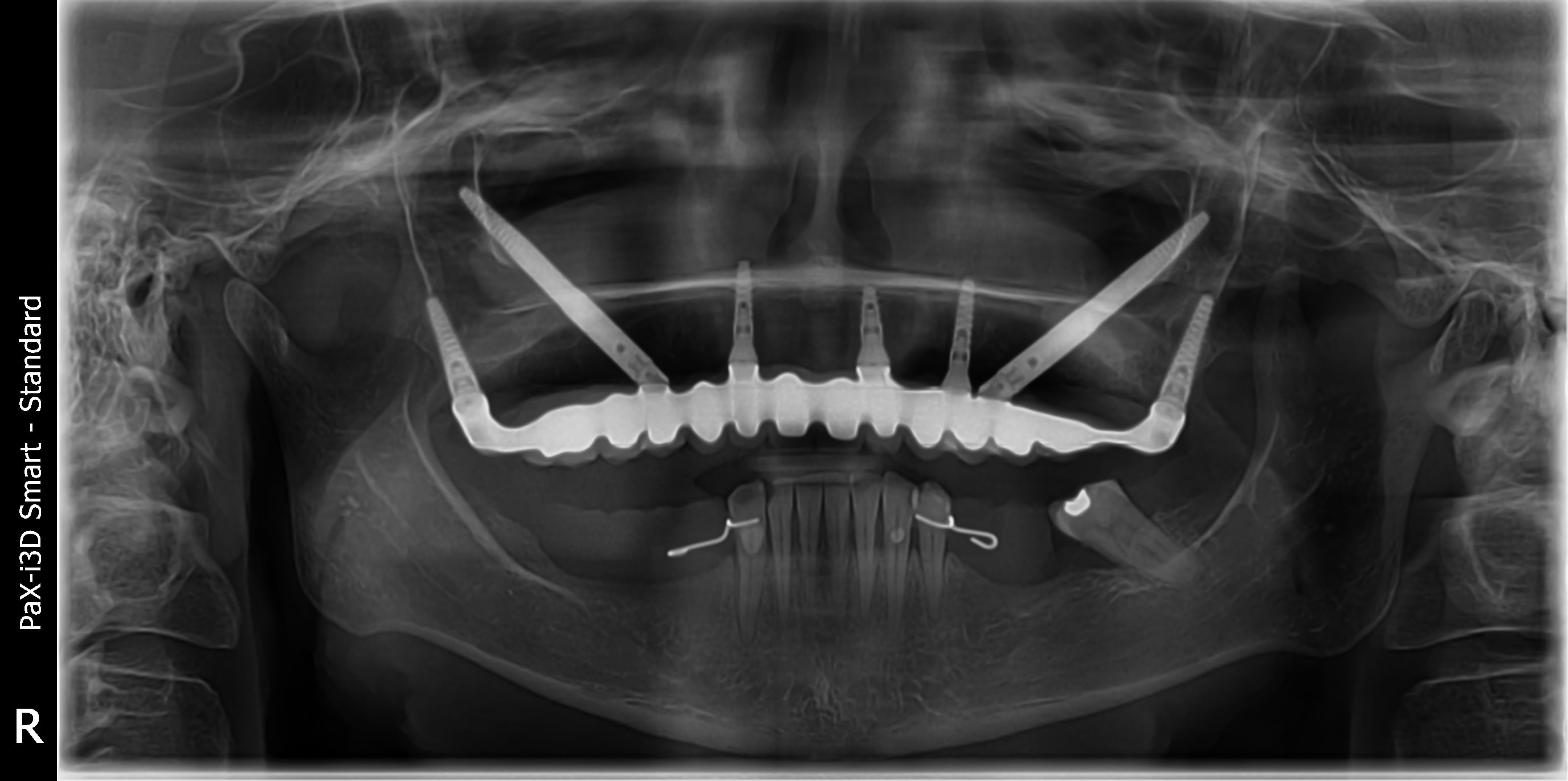 PX20231020_105742_2184_39826513-min.JPG