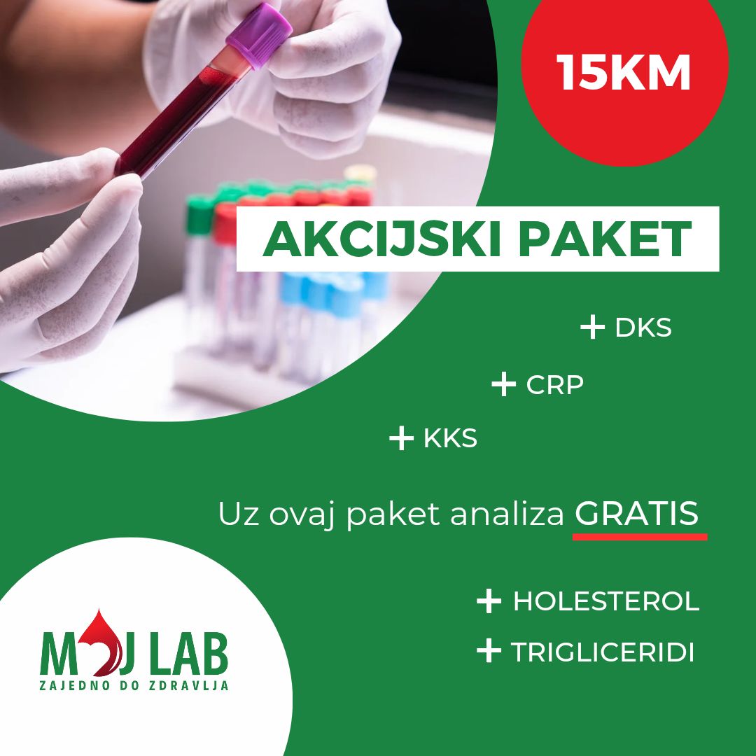 moj lab analize.jpg