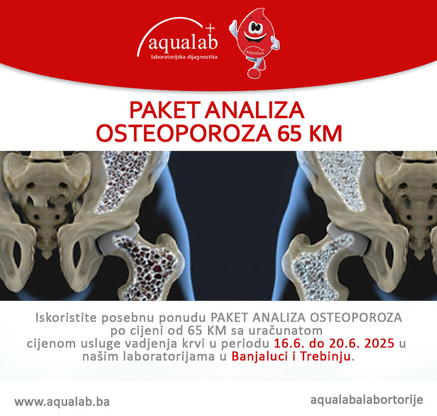 Osteoporoza analize.jpg