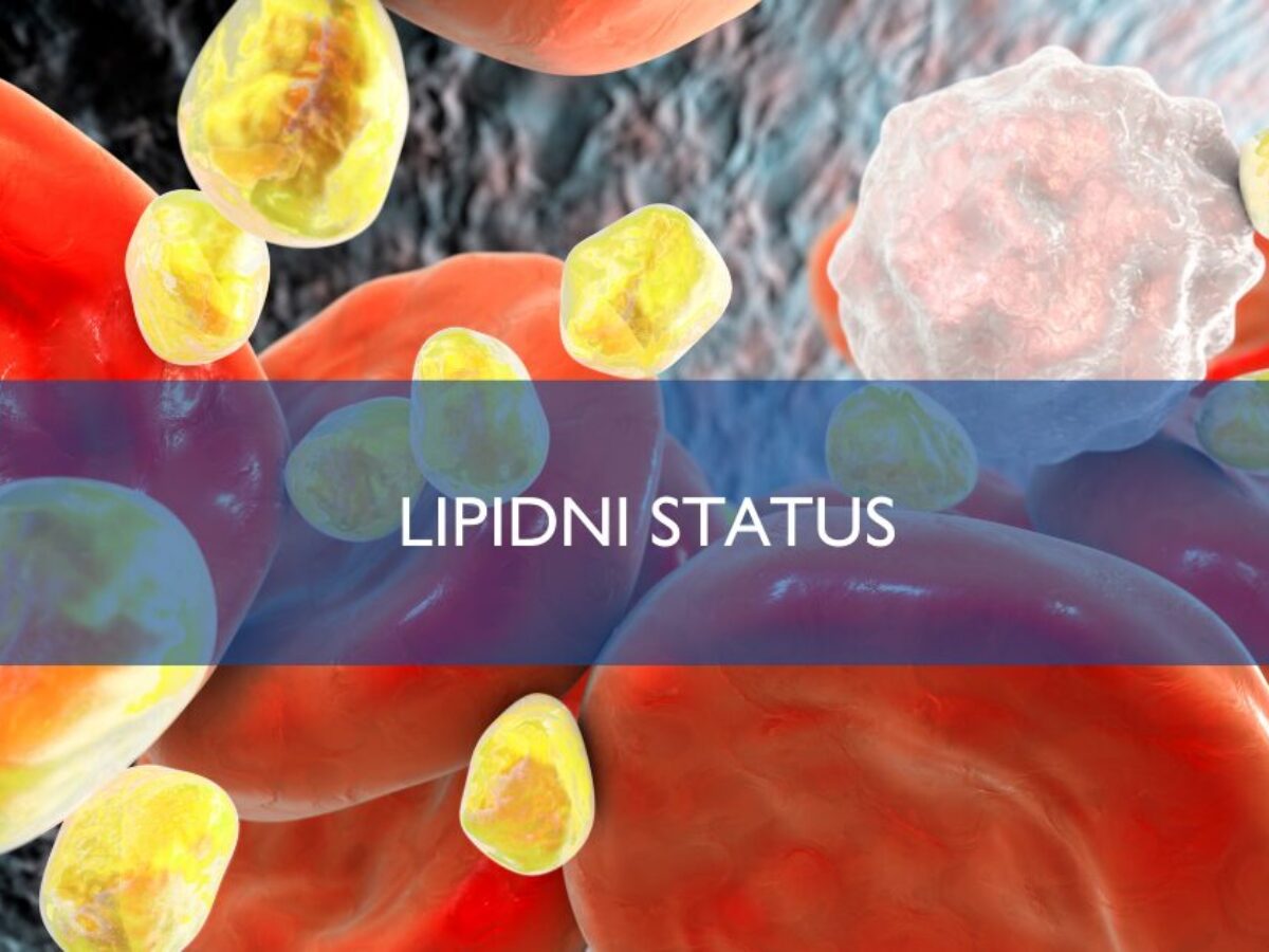 LIPIDNI-STATUS-1200x900.jpg