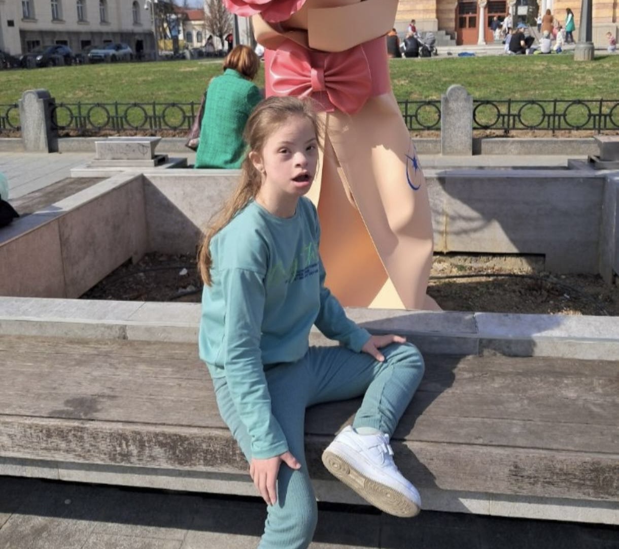 Bileca daunov sindrom1.jpeg