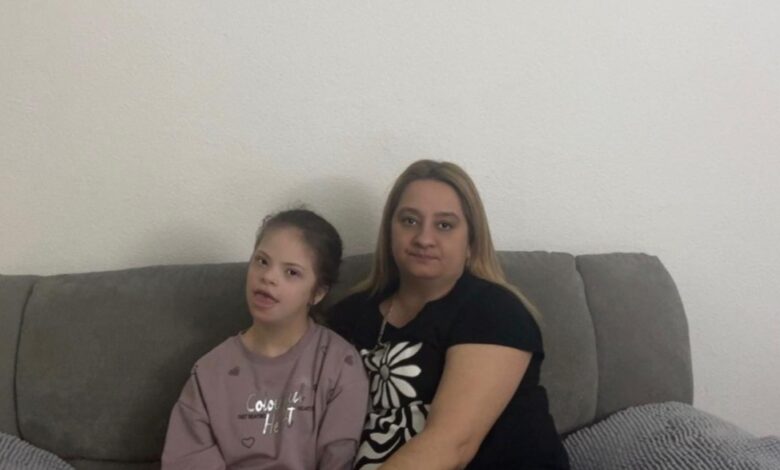 Bileca daunov sindrom3.jpeg